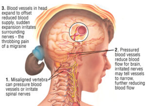 What Are some of the Dangers of Taking Fioricet for Migraine?