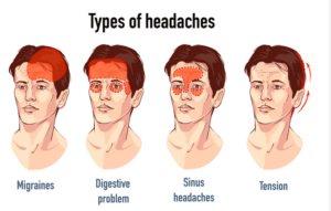 Fioricet is Used to Treat Headaches but Gabapentin is for Headache Prevention ?