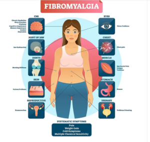 Fibromyalgia-Gabapentin- New study about Brain Fog Occurrence
